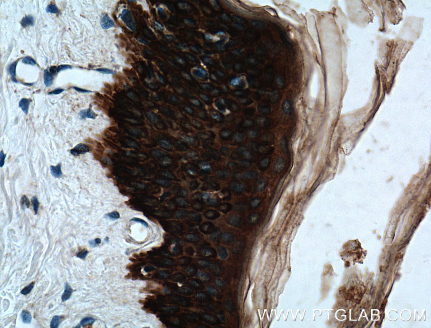 Immunohistochemistry (IHC) staining of human skin tissue using Cytokeratin 14 Polyclonal antibody (10143-1-AP)