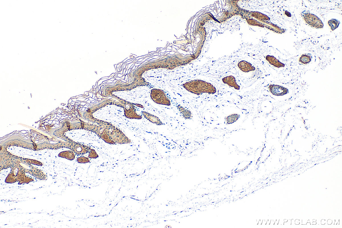 Immunohistochemical analysis of paraffin-embedded mouse skin tissue slide using 10143-1-AP (Cytokeratin 14 antibody) at dilution of 1:8000 (under 10x lens). Heat mediated antigen retrieval with Tris-EDTA buffer (pH 9.0). Immunohistochemistry (IHC) staining of mouse skin tissue using Cytokeratin 14 Polyclonal antibody (10143-1-AP)