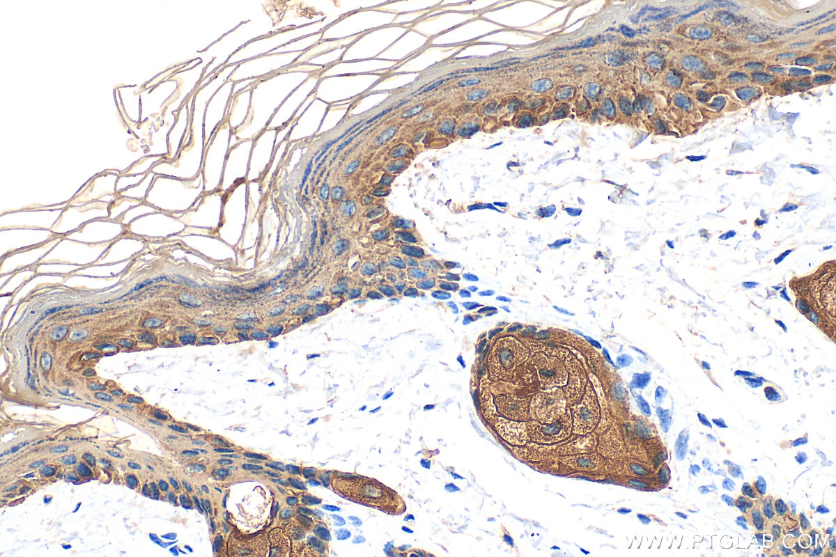 Immunohistochemical analysis of paraffin-embedded mouse skin tissue slide using 10143-1-AP (Cytokeratin 14 antibody) at dilution of 1:8000 (under 40x lens). Heat mediated antigen retrieval with Tris-EDTA buffer (pH 9.0). Immunohistochemistry (IHC) staining of mouse skin tissue using Cytokeratin 14 Polyclonal antibody (10143-1-AP)