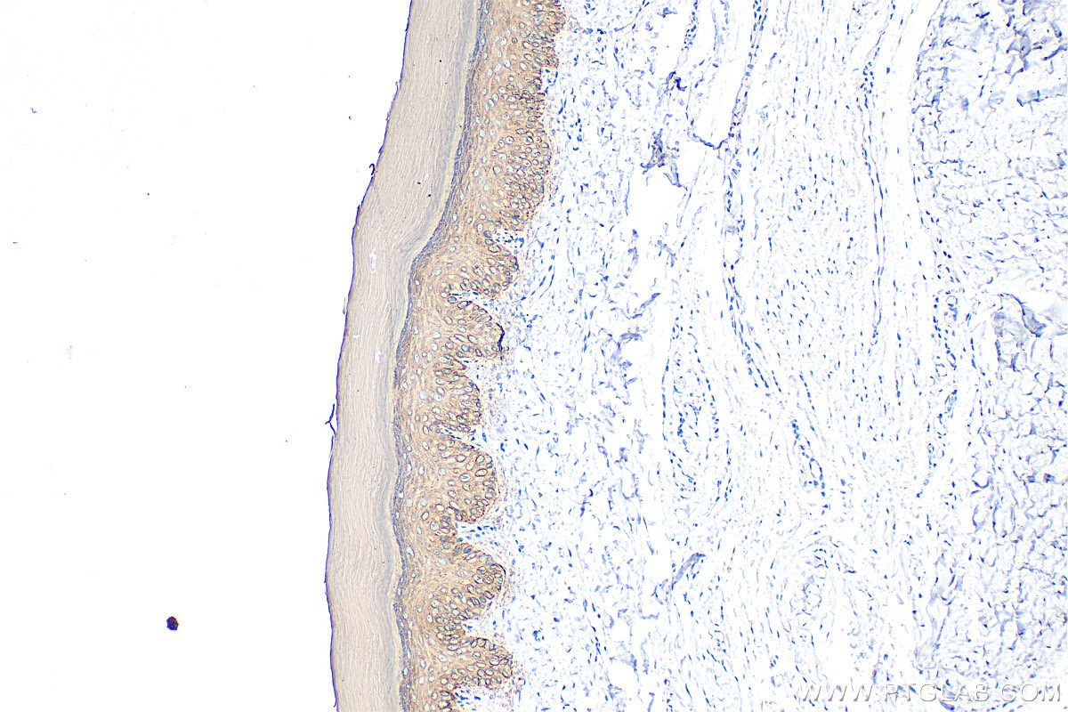 Immunohistochemical analysis of paraffin-embedded rat skin tissue slide using 10143-1-AP (Cytokeratin 14 antibody) at dilution of 1:8000 (under 10x lens). Heat mediated antigen retrieval with Tris-EDTA buffer (pH 9.0). Immunohistochemistry (IHC) staining of rat skin tissue using Cytokeratin 14 Polyclonal antibody (10143-1-AP)