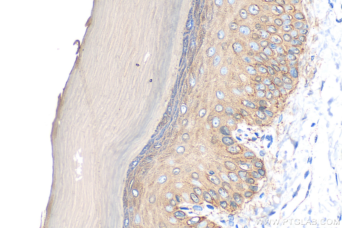 Immunohistochemical analysis of paraffin-embedded rat skin tissue slide using 10143-1-AP (Cytokeratin 14 antibody) at dilution of 1:8000 (under 40x lens). Heat mediated antigen retrieval with Tris-EDTA buffer (pH 9.0). Immunohistochemistry (IHC) staining of rat skin tissue using Cytokeratin 14 Polyclonal antibody (10143-1-AP)