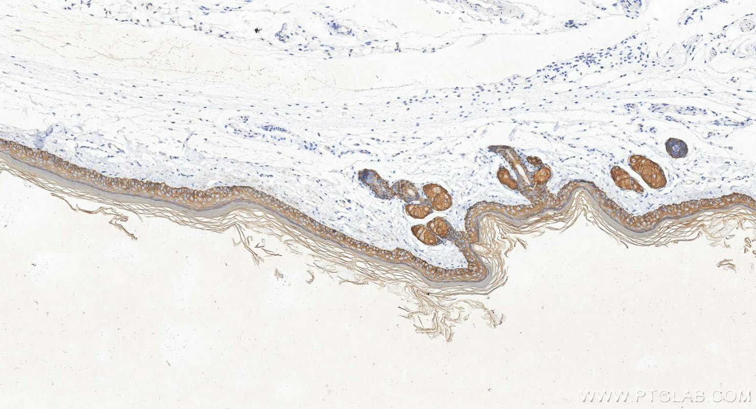 Immunohistochemistry (IHC) staining of mouse skin tissue using Cytokeratin 14 Polyclonal antibody (10143-1-AP)