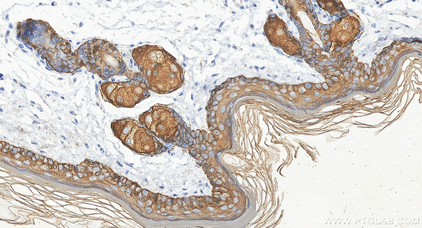 Immunohistochemistry (IHC) staining of mouse skin tissue using Cytokeratin 14 Polyclonal antibody (10143-1-AP)
