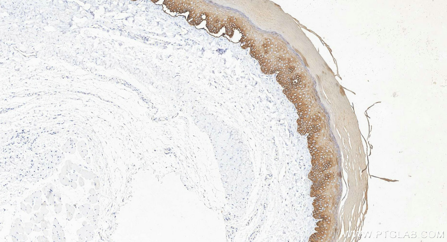 Immunohistochemistry (IHC) staining of rat skin tissue using Cytokeratin 14 Polyclonal antibody (10143-1-AP)