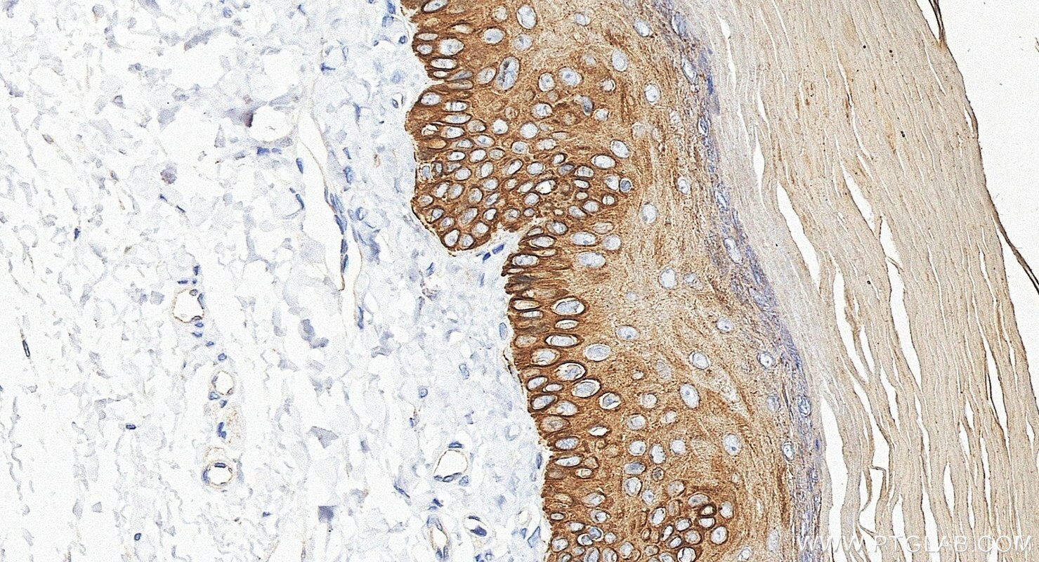 Immunohistochemistry (IHC) staining of rat skin tissue using Cytokeratin 14 Polyclonal antibody (10143-1-AP)