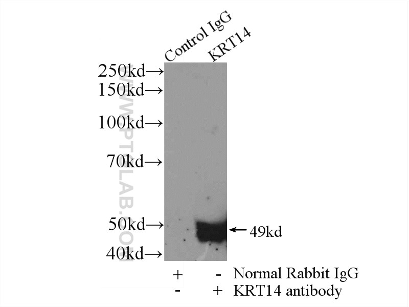 Immunoprecipitation (IP) experiment of A431 cells using Cytokeratin 14 Polyclonal antibody (10143-1-AP)