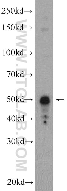 Western Blot (WB) analysis of rat skin tissue using Cytokeratin 14 Polyclonal antibody (10143-1-AP)