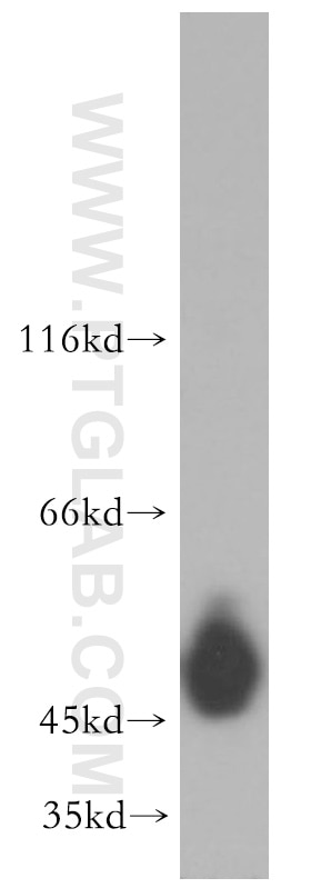 Western Blot (WB) analysis of A431 cells using Cytokeratin 14 Polyclonal antibody (10143-1-AP)