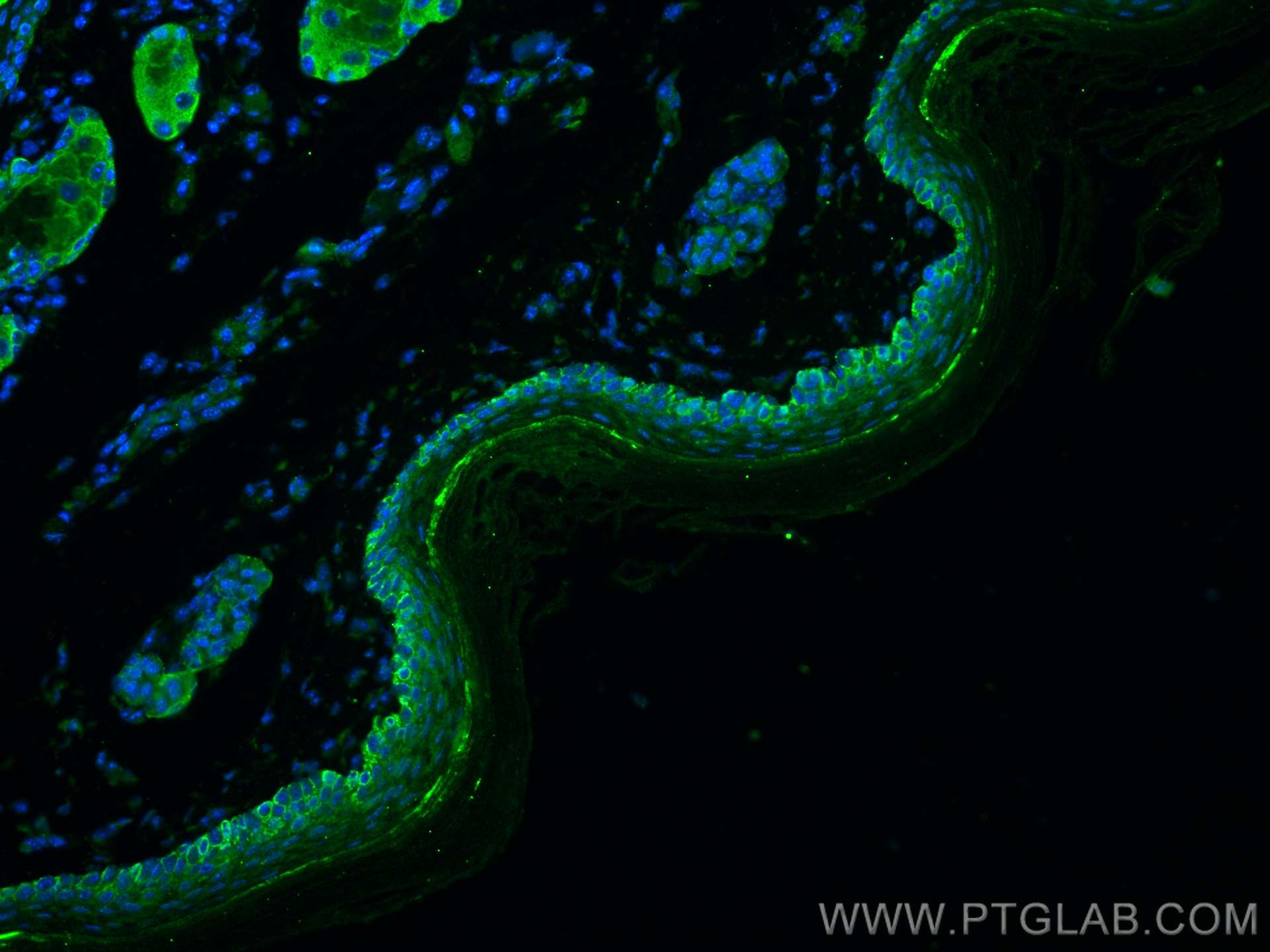 Immunofluorescence (IF) / fluorescent staining of mouse skin tissue using Cytokeratin 14 Polyclonal antibody (22221-1-AP)