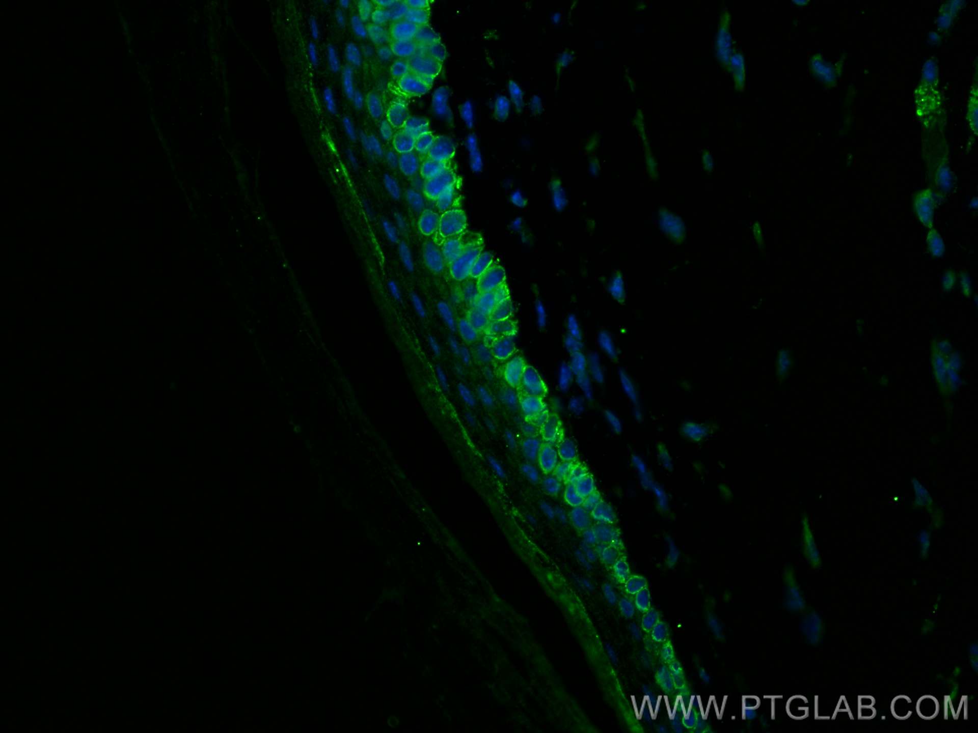 Immunofluorescence (IF) / fluorescent staining of mouse skin tissue using Cytokeratin 14 Polyclonal antibody (22221-1-AP)