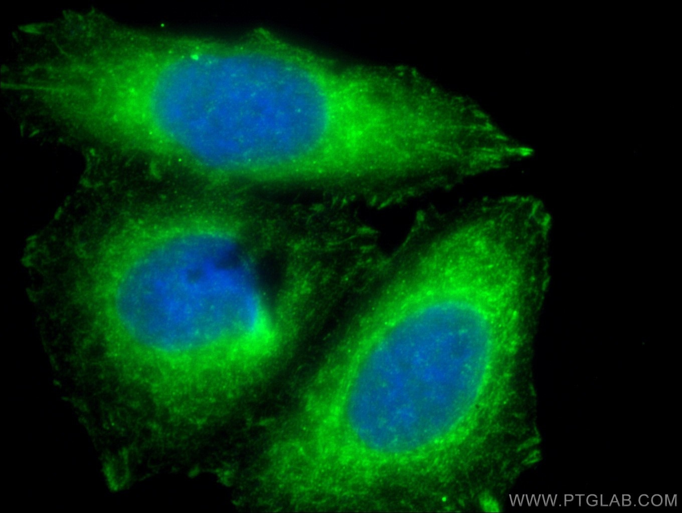 Immunofluorescence (IF) / fluorescent staining of HepG2 cells using Cytokeratin 14 Polyclonal antibody (22221-1-AP)