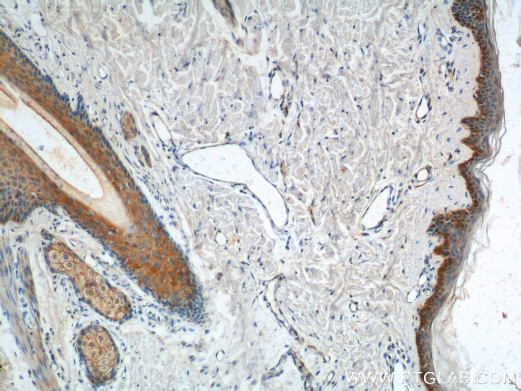 IHC staining of human skin using 22221-1-AP