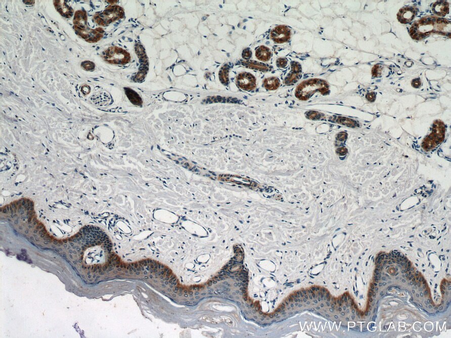 Cytokeratin 14