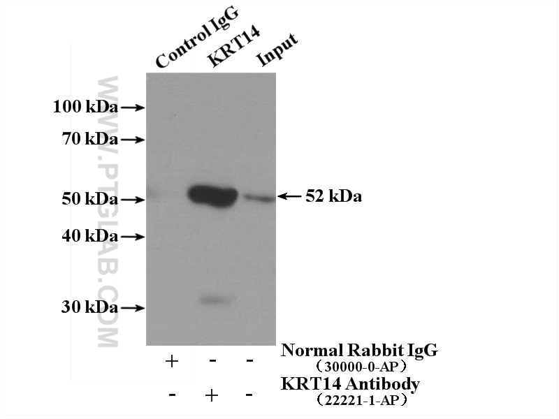 Immunoprecipitation (IP) experiment of mouse skin tissue using Cytokeratin 14 Polyclonal antibody (22221-1-AP)