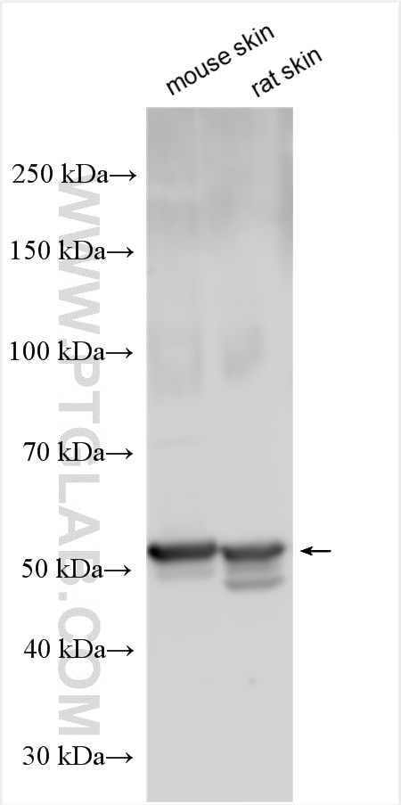 Western Blot (WB) analysis of various lysates using Cytokeratin 14 Polyclonal antibody (22221-1-AP)