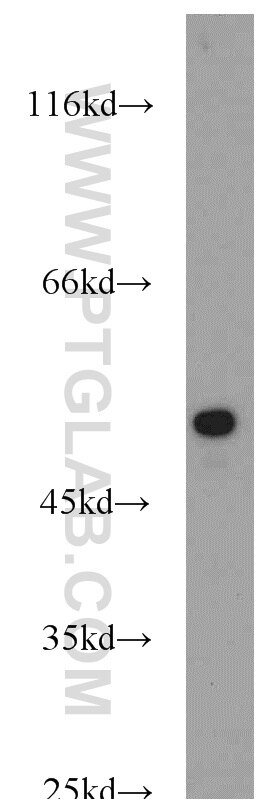 Western Blot (WB) analysis of mouse skin tissue using Cytokeratin 14 Polyclonal antibody (22221-1-AP)