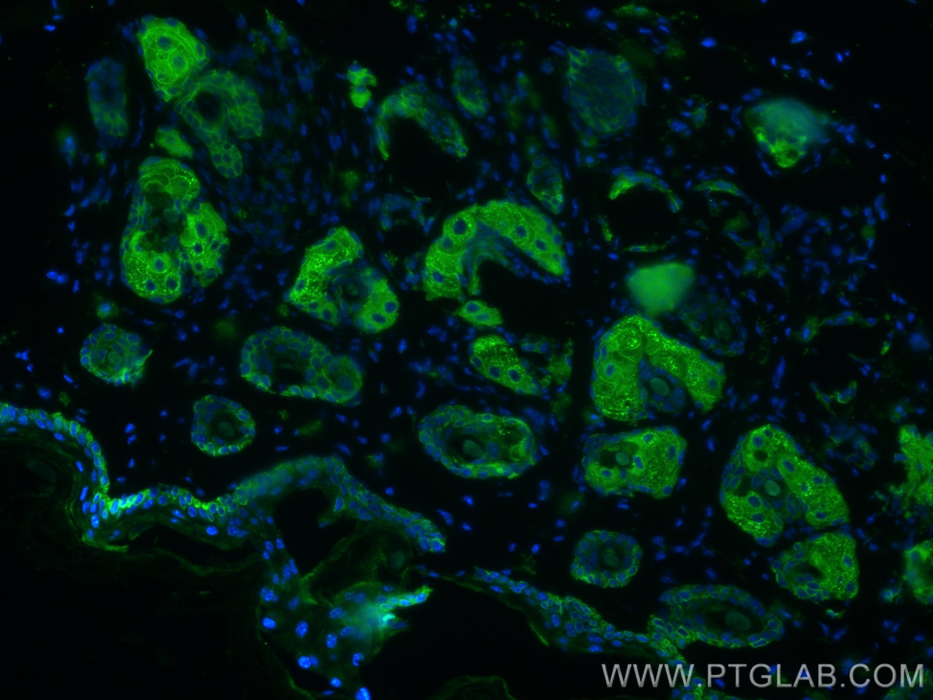 Immunofluorescence (IF) / fluorescent staining of mouse skin tissue using Cytokeratin 14 Monoclonal antibody (60320-1-Ig)