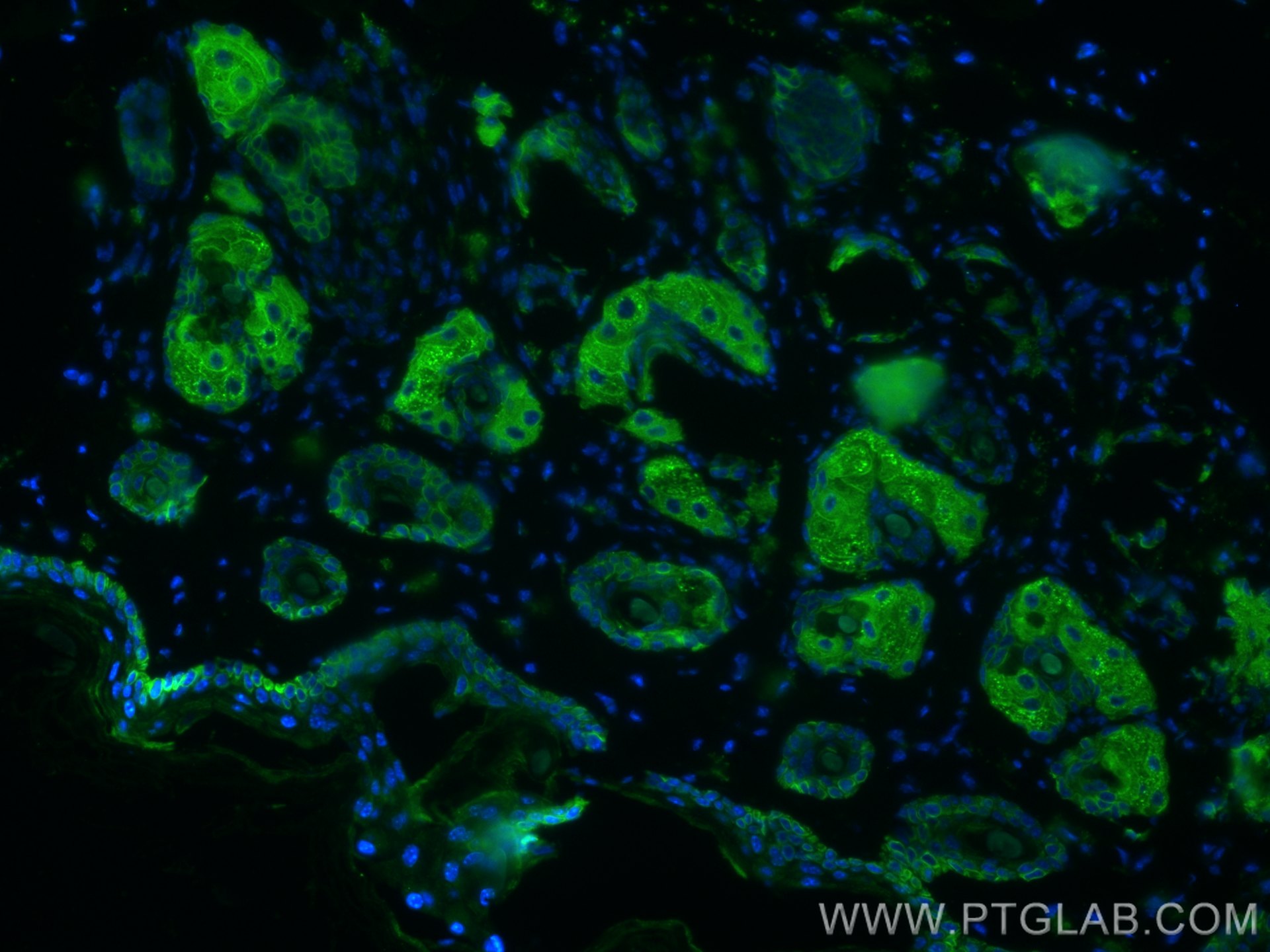 IF Staining of mouse skin using 60320-1-Ig