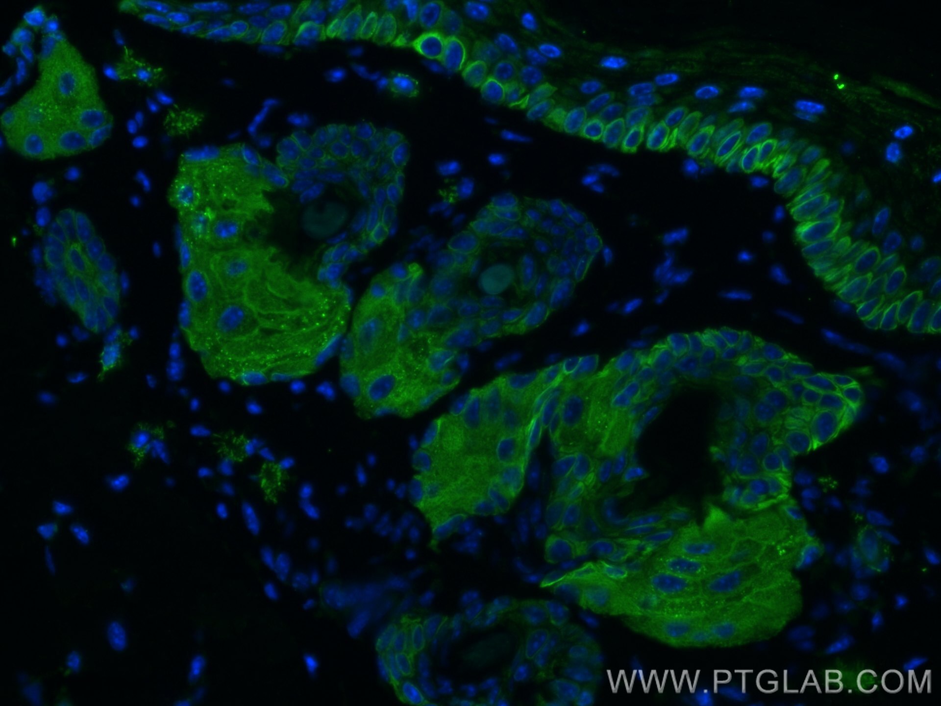 Immunofluorescence (IF) / fluorescent staining of mouse skin tissue using Cytokeratin 14 Monoclonal antibody (60320-1-Ig)