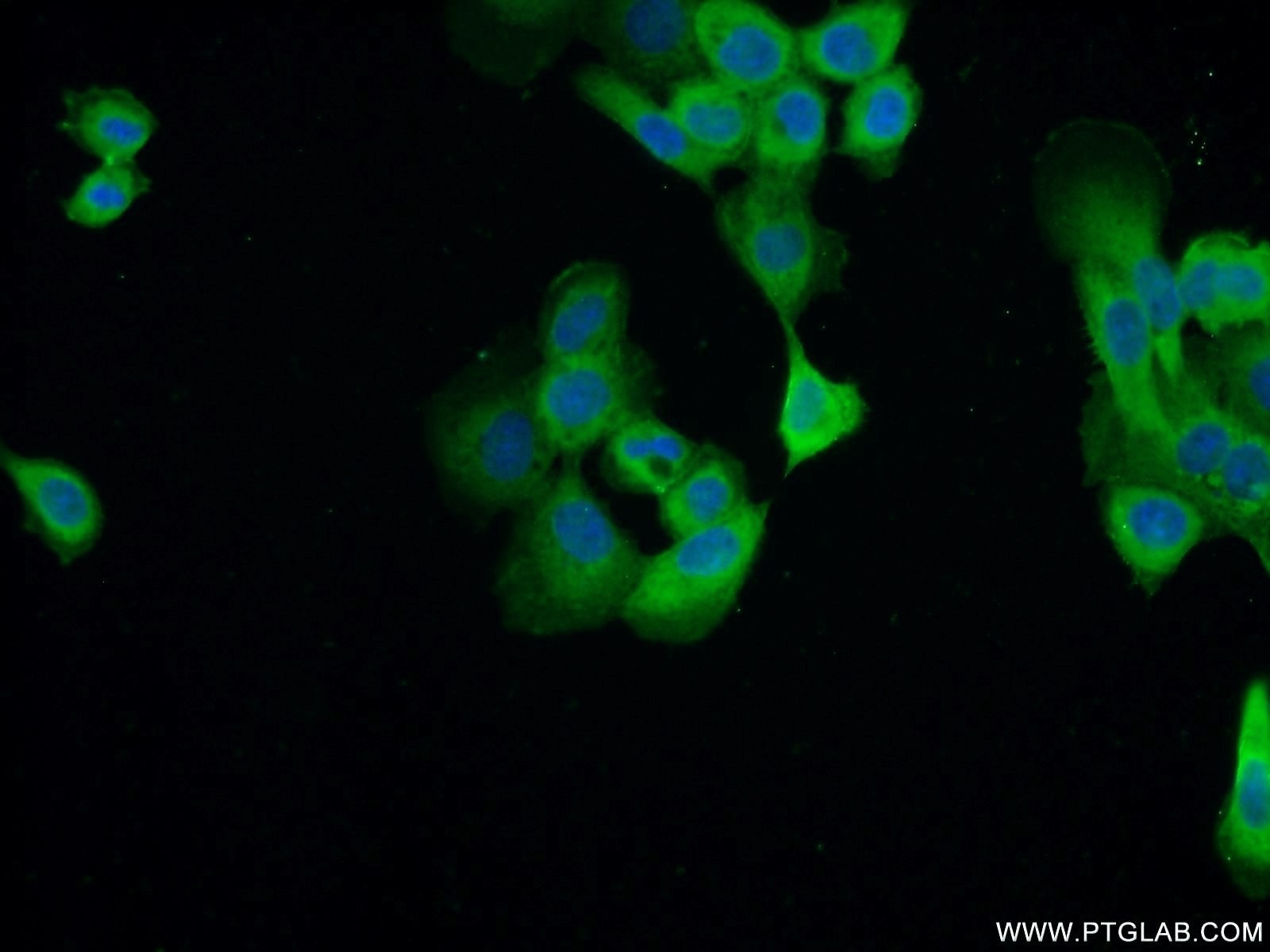 Immunofluorescence (IF) / fluorescent staining of A431 cells using Cytokeratin 14 Monoclonal antibody (60320-1-Ig)