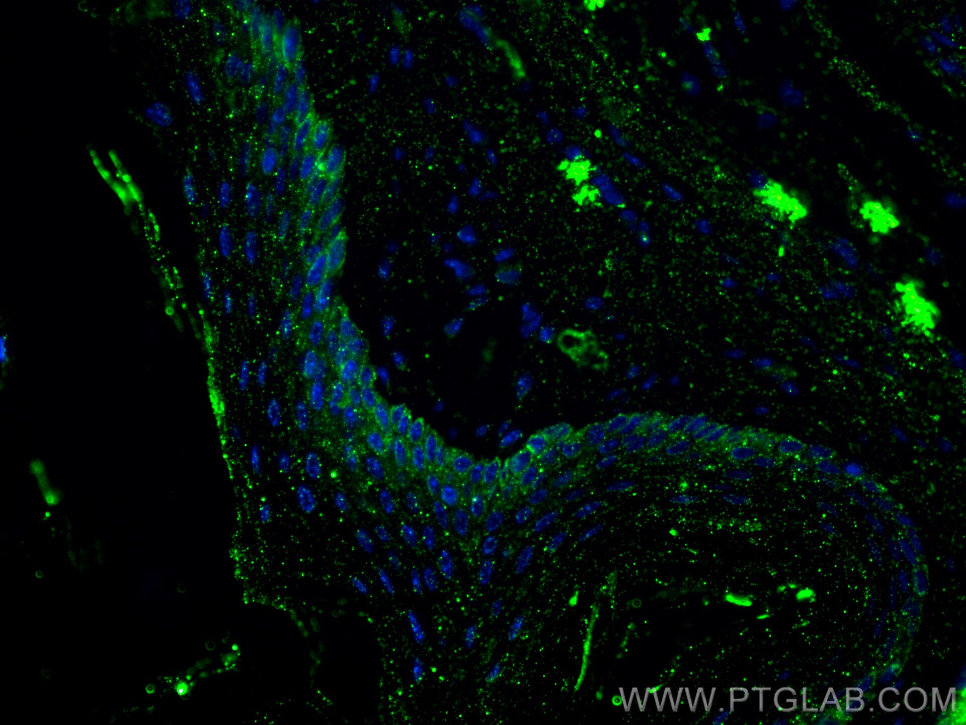 Immunofluorescence (IF) / fluorescent staining of mouse skin tissue using Cytokeratin 14 Monoclonal antibody (60320-1-Ig)