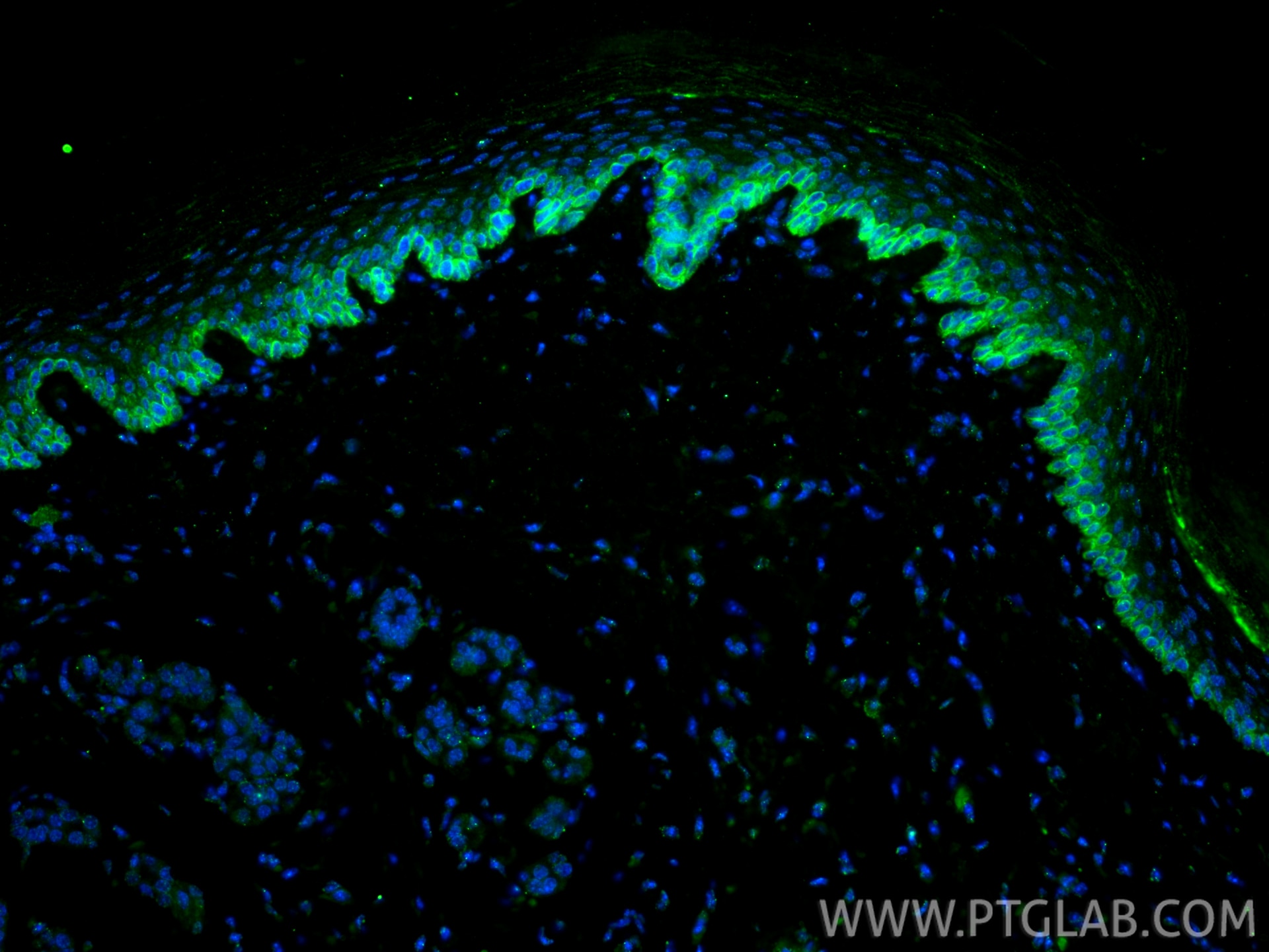 Immunofluorescence (IF) / fluorescent staining of mouse skin tissue using Cytokeratin 14 Monoclonal antibody (60320-1-Ig)