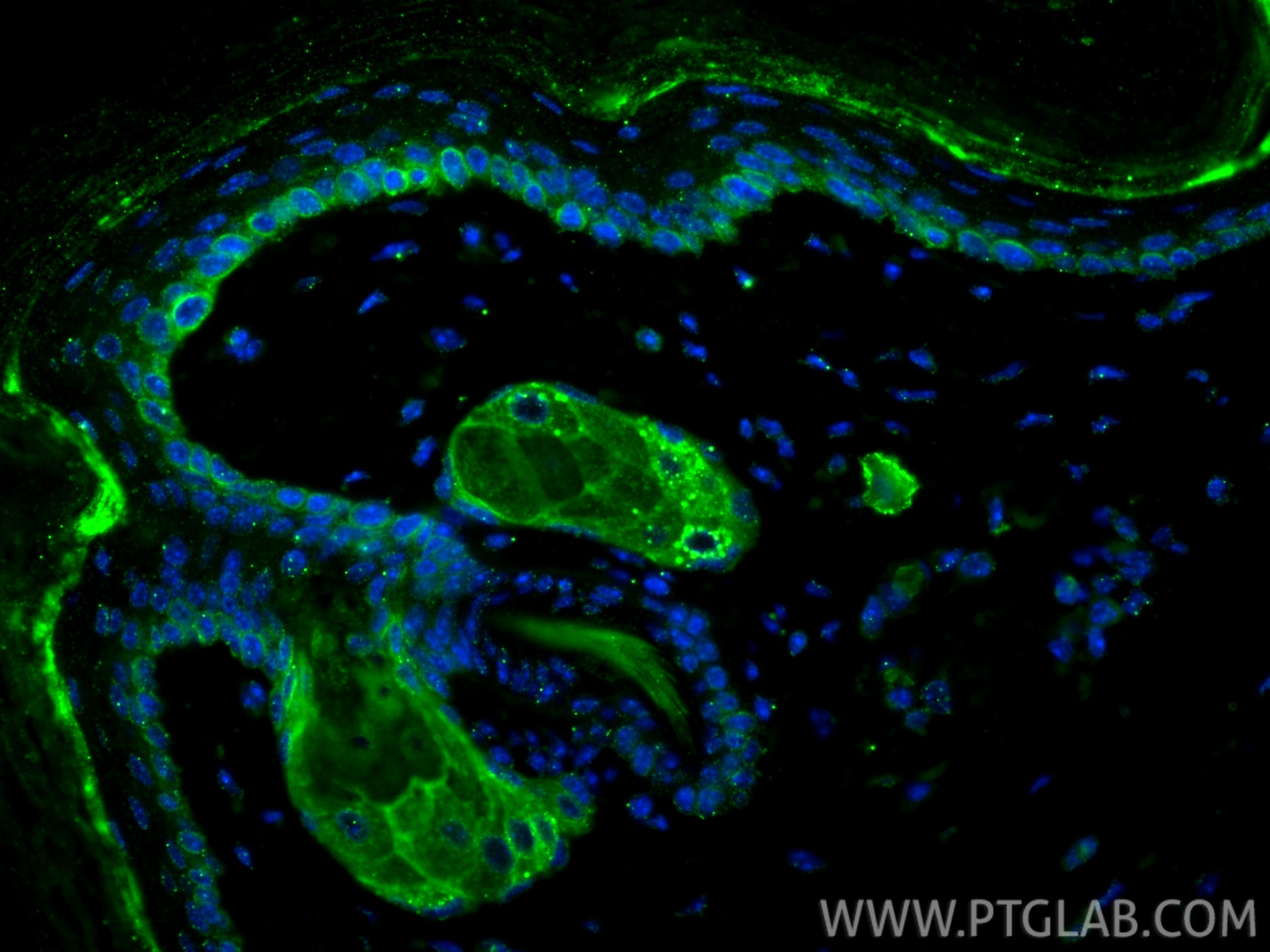 Immunofluorescence (IF) / fluorescent staining of mouse skin tissue using Cytokeratin 14 Monoclonal antibody (60320-1-Ig)