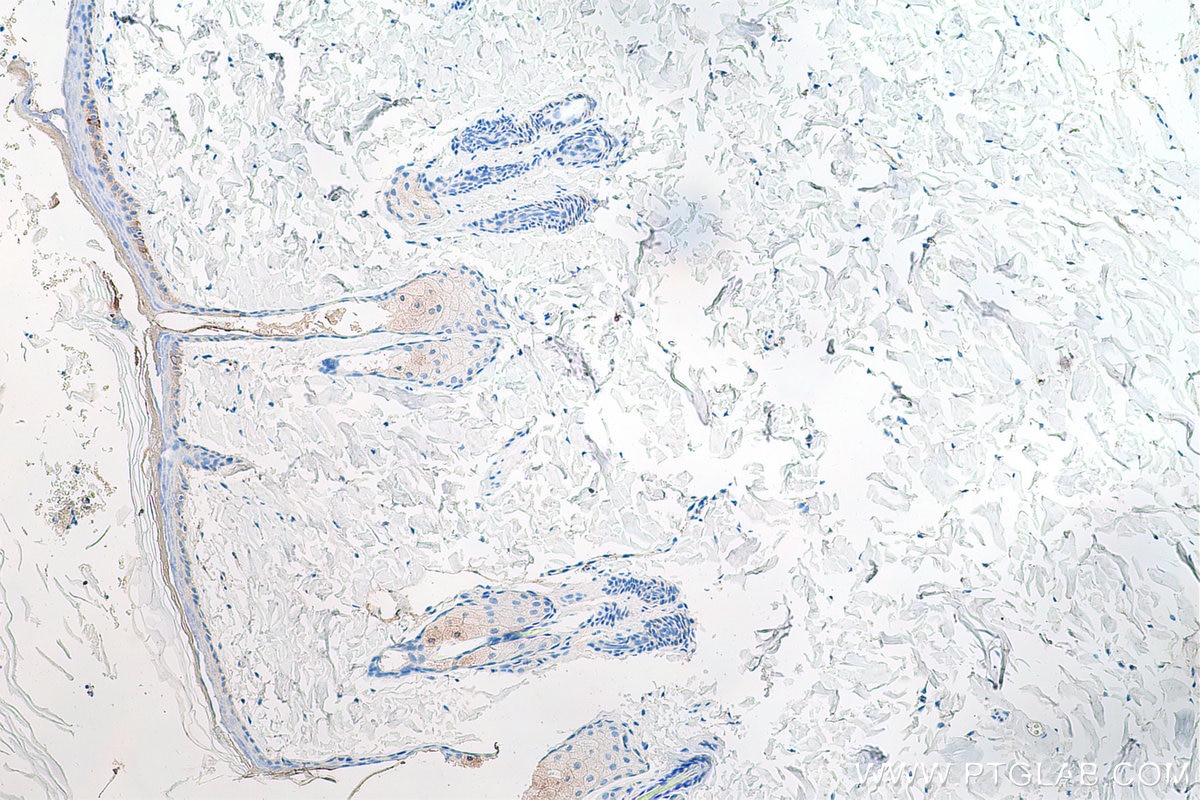 Immunohistochemistry (IHC) staining of rat skin tissue using Cytokeratin 14 Monoclonal antibody (60320-1-Ig)