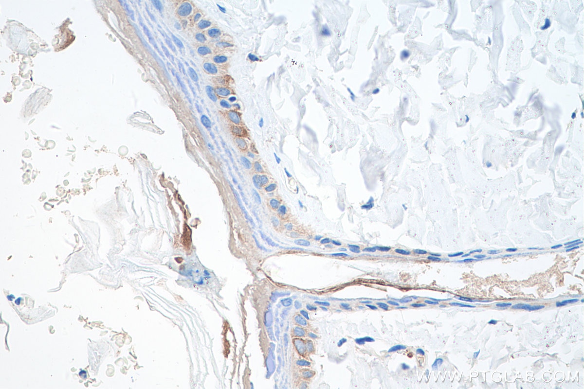 Immunohistochemistry (IHC) staining of rat skin tissue using Cytokeratin 14 Monoclonal antibody (60320-1-Ig)