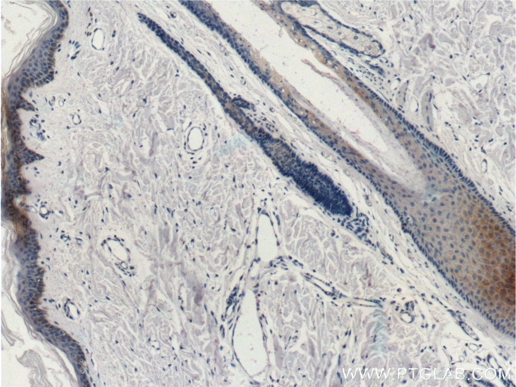 Immunohistochemistry (IHC) staining of human skin tissue using Cytokeratin 14 Monoclonal antibody (60320-1-Ig)
