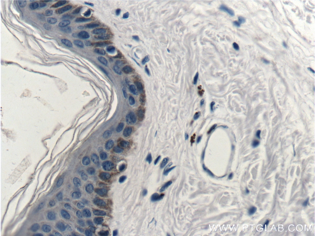 Immunohistochemistry (IHC) staining of human skin tissue using Cytokeratin 14 Monoclonal antibody (60320-1-Ig)