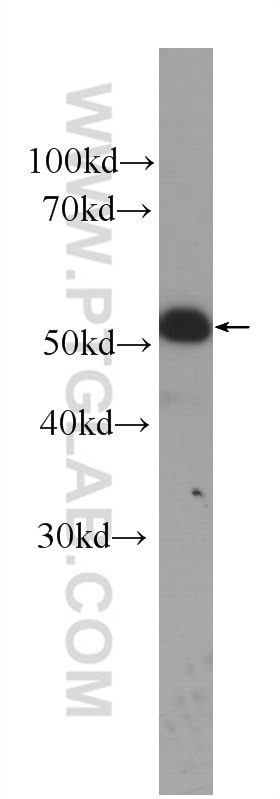 Western Blot (WB) analysis of A431 cells using Cytokeratin 14 Monoclonal antibody (60320-1-Ig)