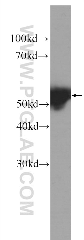 Western Blot (WB) analysis of mouse skin tissue using Cytokeratin 14 Monoclonal antibody (60320-1-Ig)