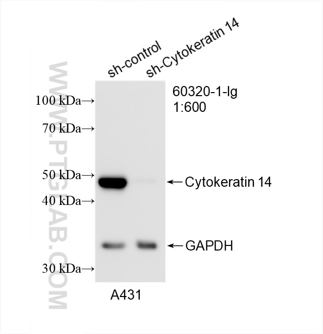 Western Blot (WB) analysis of A431 cells using Cytokeratin 14 Monoclonal antibody (60320-1-Ig)