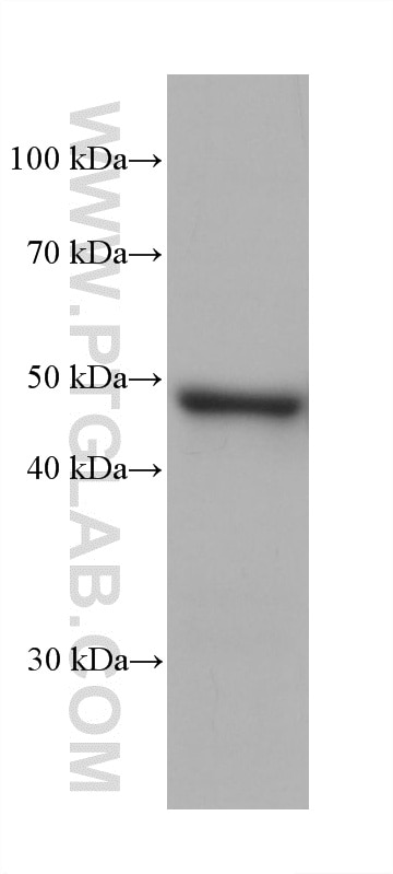 Western Blot (WB) analysis of FaDu cells using Cytokeratin 14 Monoclonal antibody (60320-1-Ig)