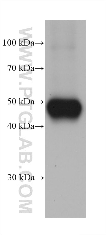 Western Blot (WB) analysis of HT-1376 cells using Cytokeratin 14 Monoclonal antibody (60320-1-Ig)