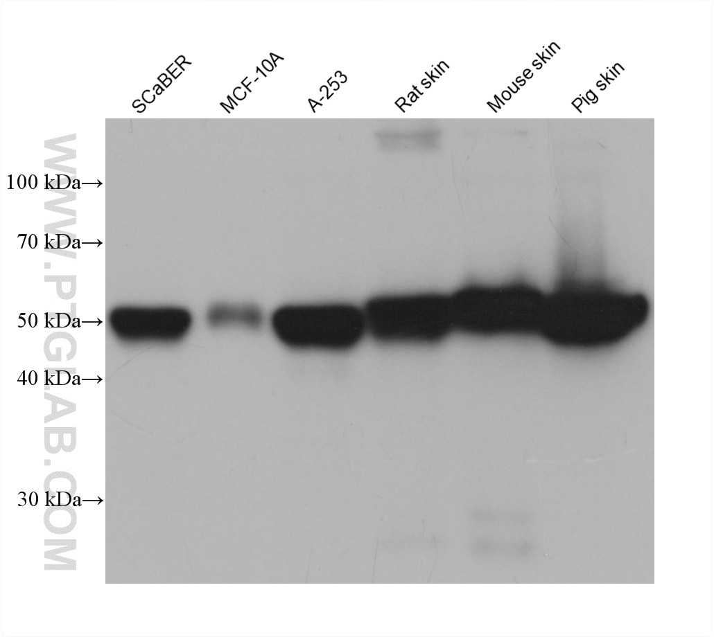 Western Blot (WB) analysis of various lysates using Cytokeratin 14 Monoclonal antibody (60320-1-Ig)