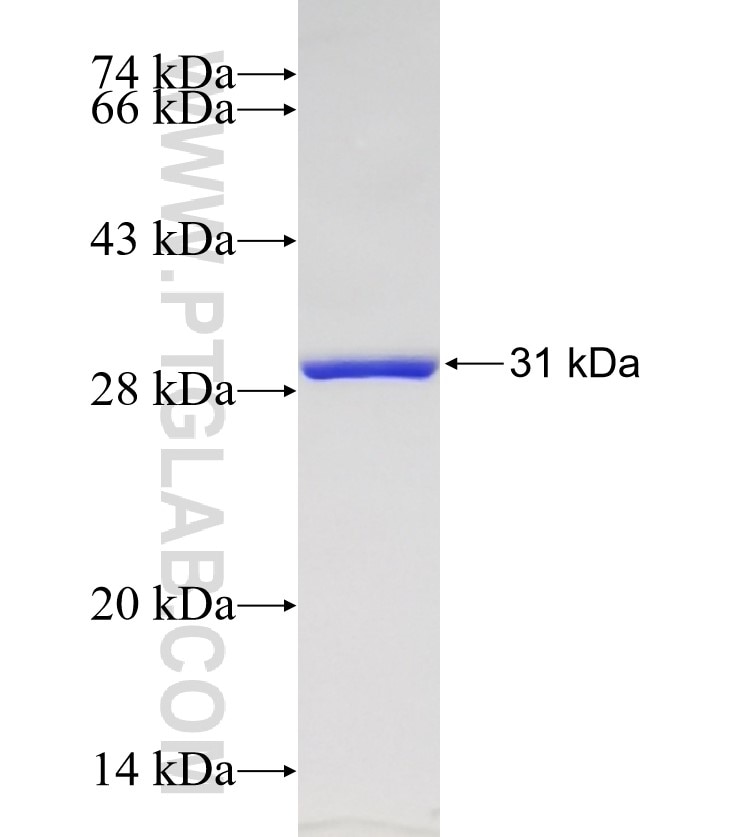 KRT14 fusion protein Ag17559 SDS-PAGE