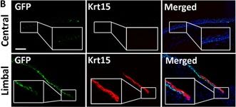 Cytokeratin 15