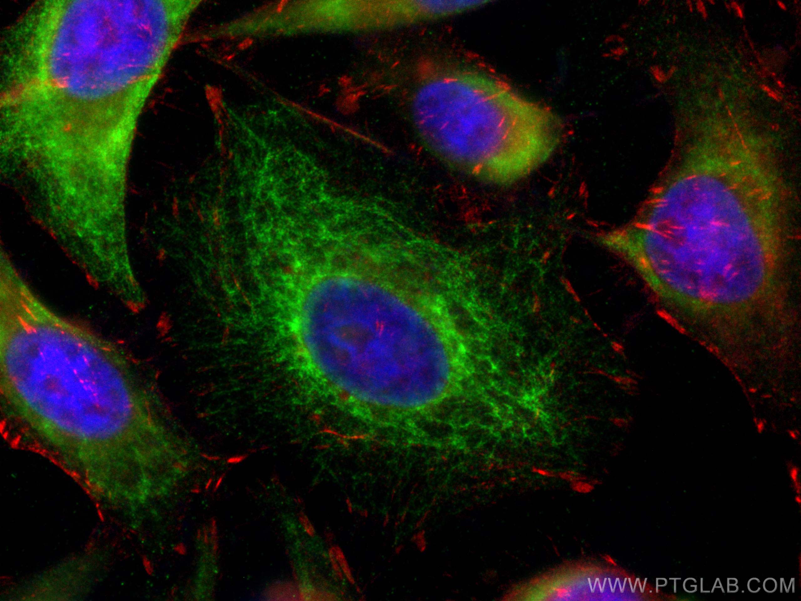 Immunofluorescence (IF) / fluorescent staining of HeLa cells using Cytokeratin 15 Polyclonal antibody (10137-1-AP)