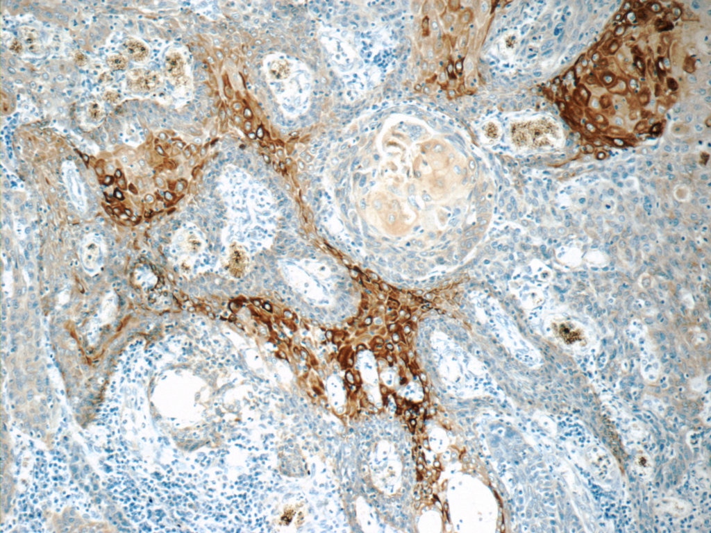 Cytokeratin 15 Polyclonal antibody