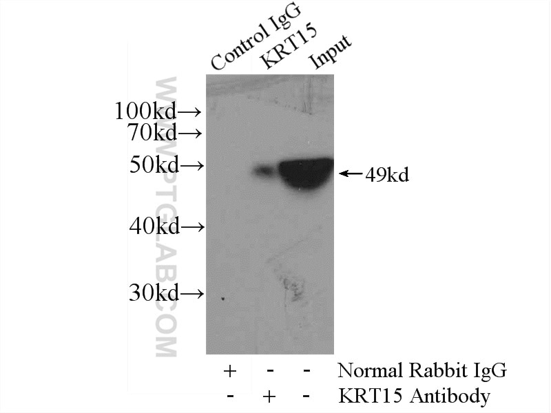 Immunoprecipitation (IP) experiment of A431 cells using Cytokeratin 15 Polyclonal antibody (10137-1-AP)