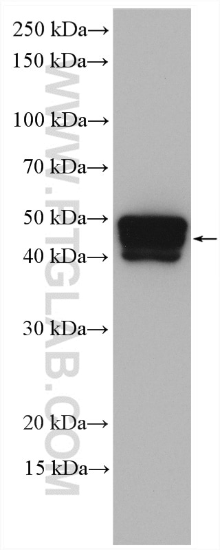 Western Blot (WB) analysis of A431 cells using Cytokeratin 15 Polyclonal antibody (10137-1-AP)