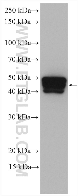 WB analysis of A431 using 10137-1-AP