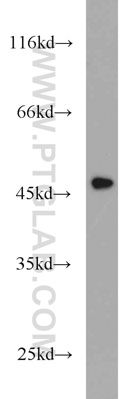 Western Blot (WB) analysis of mouse thymus tissue using Cytokeratin 15 Polyclonal antibody (10137-1-AP)