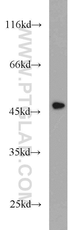 WB analysis of mouse thymus using 10137-1-AP