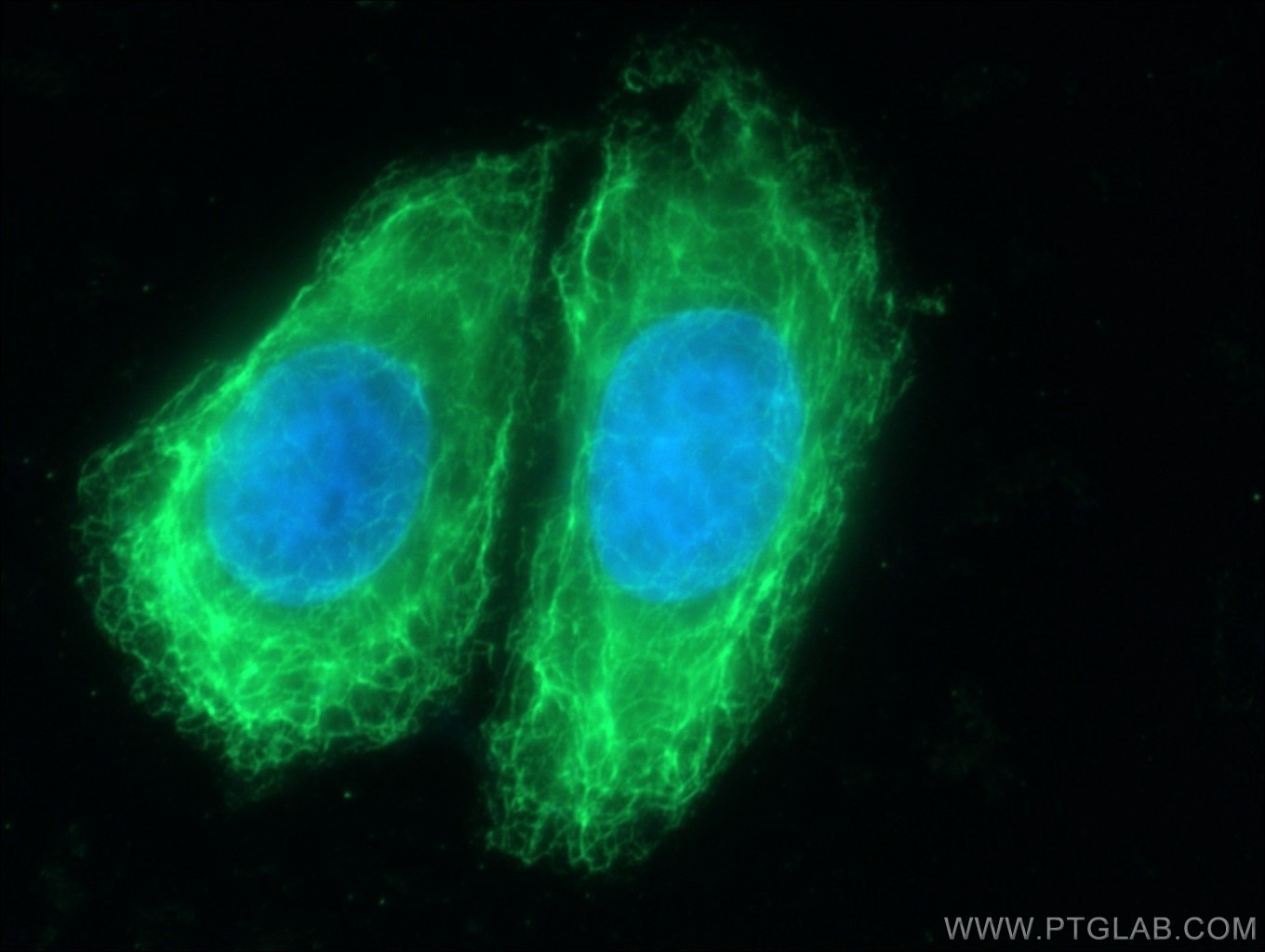 Immunofluorescence (IF) / fluorescent staining of HeLa cells using Cytokeratin 15 Monoclonal antibody (60247-1-Ig)