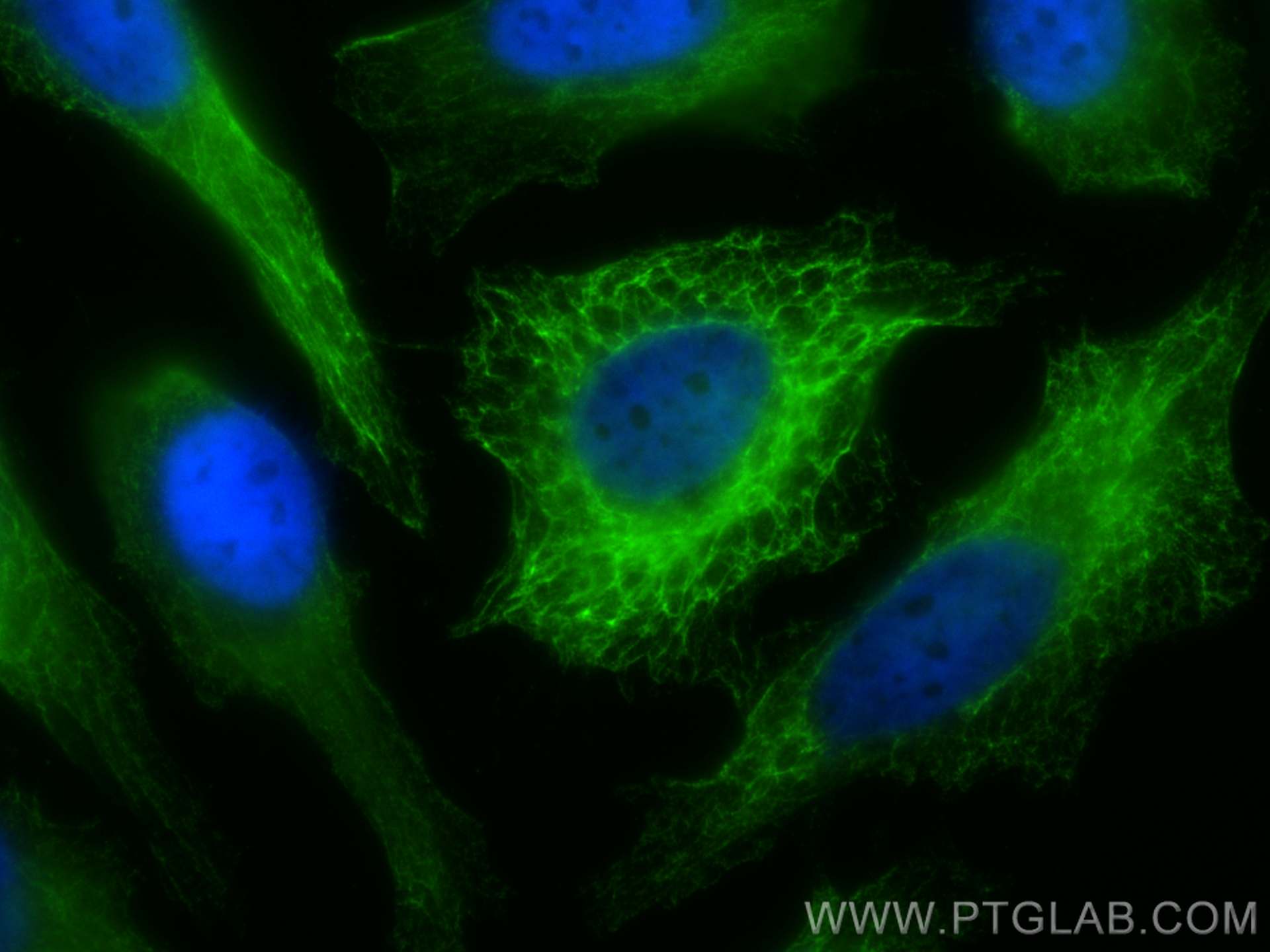 Immunofluorescence (IF) / fluorescent staining of HeLa cells using Cytokeratin 15 Monoclonal antibody (60247-1-Ig)