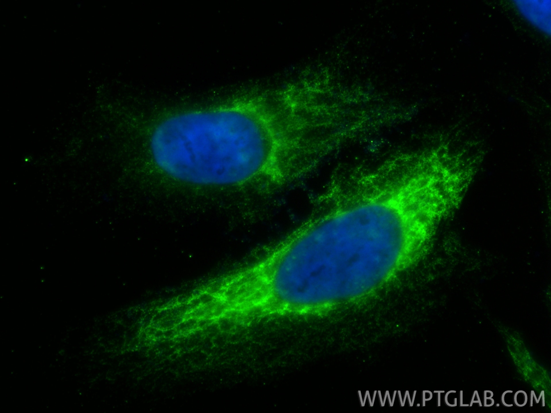 Immunofluorescent analysis of (-20°C Methanol) fixed HeLa cells using Cytokeratin 15 antibody (60247-1-Ig, Clone: 6B4F8 ) at dilution of 1:250 and CoraLite®488-Conjugated Goat Anti-Mouse IgG(H+L) (SA00013-1). Immunofluorescence (IF) / fluorescent staining of HeLa cells using Cytokeratin 15 Monoclonal antibody (60247-1-Ig)