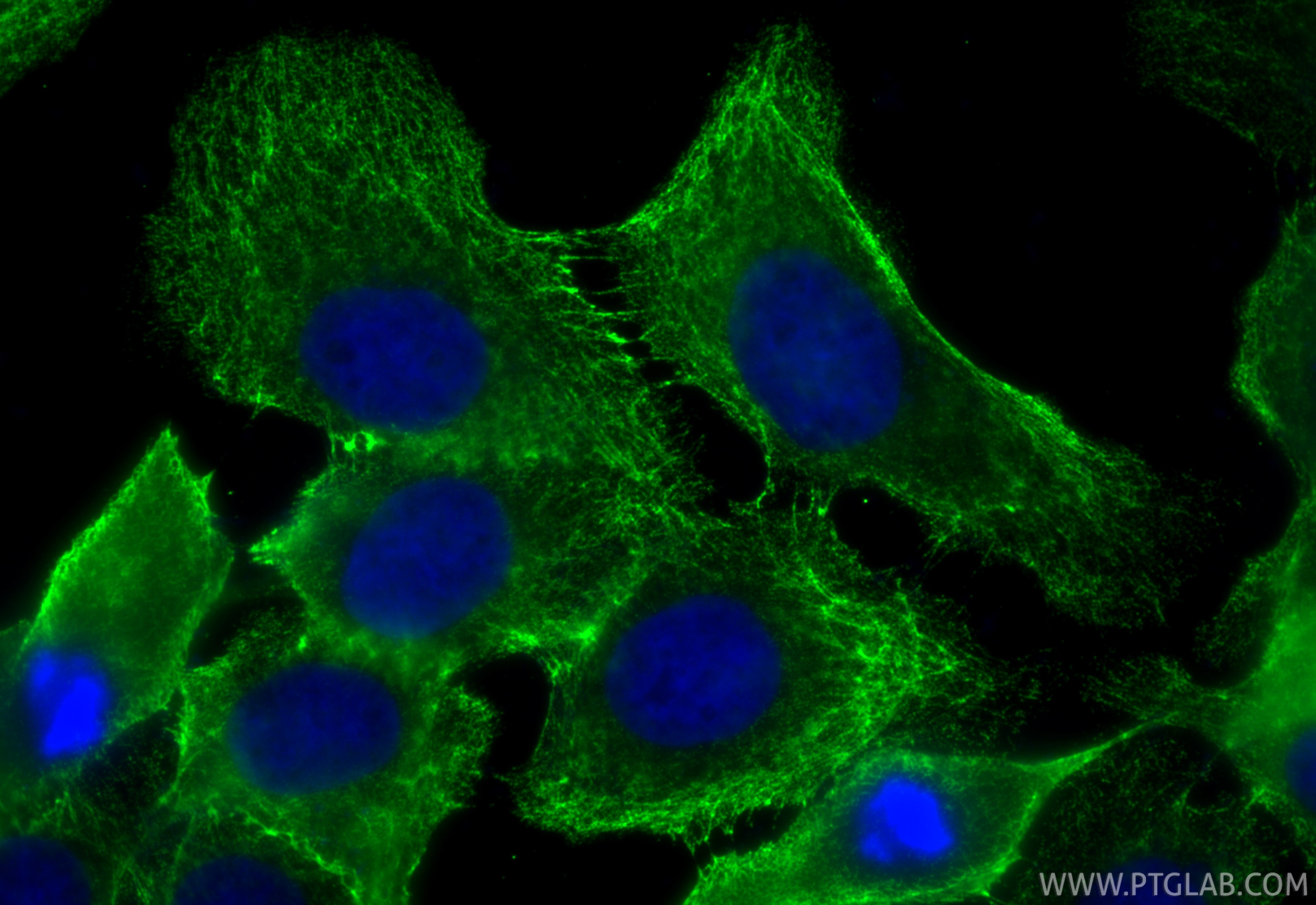 Immunofluorescence (IF) / fluorescent staining of A431 cells using Cytokeratin 15 Monoclonal antibody (60247-1-Ig)